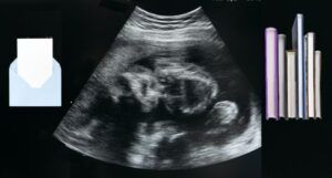 image of a sonogram with books and a card