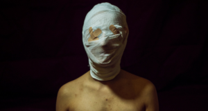 a photo of a person with gauze wrapped around their face and bandaids over their eyes