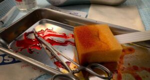 a tray of bloody surgical instruments, including a sponge and surgical scissors